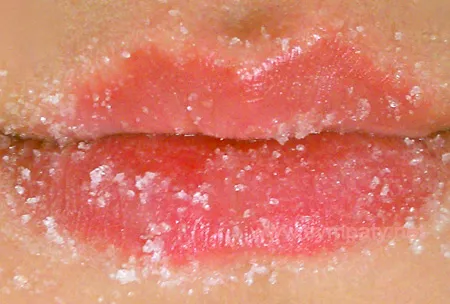 Отшелушивание губ.