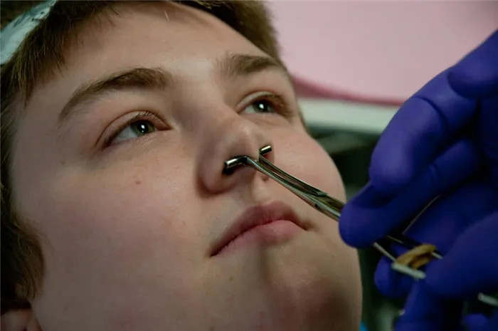 Со скольки лет можно делать пирсинг детям и подросткам